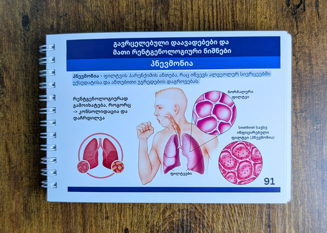 გულმკერდის რენტგენოლოგიის ბარათები